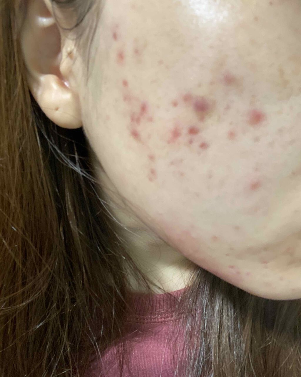 モイスチャー クリアソープ/アルージェ/洗顔石鹸を使ったクチコミ（1枚目）