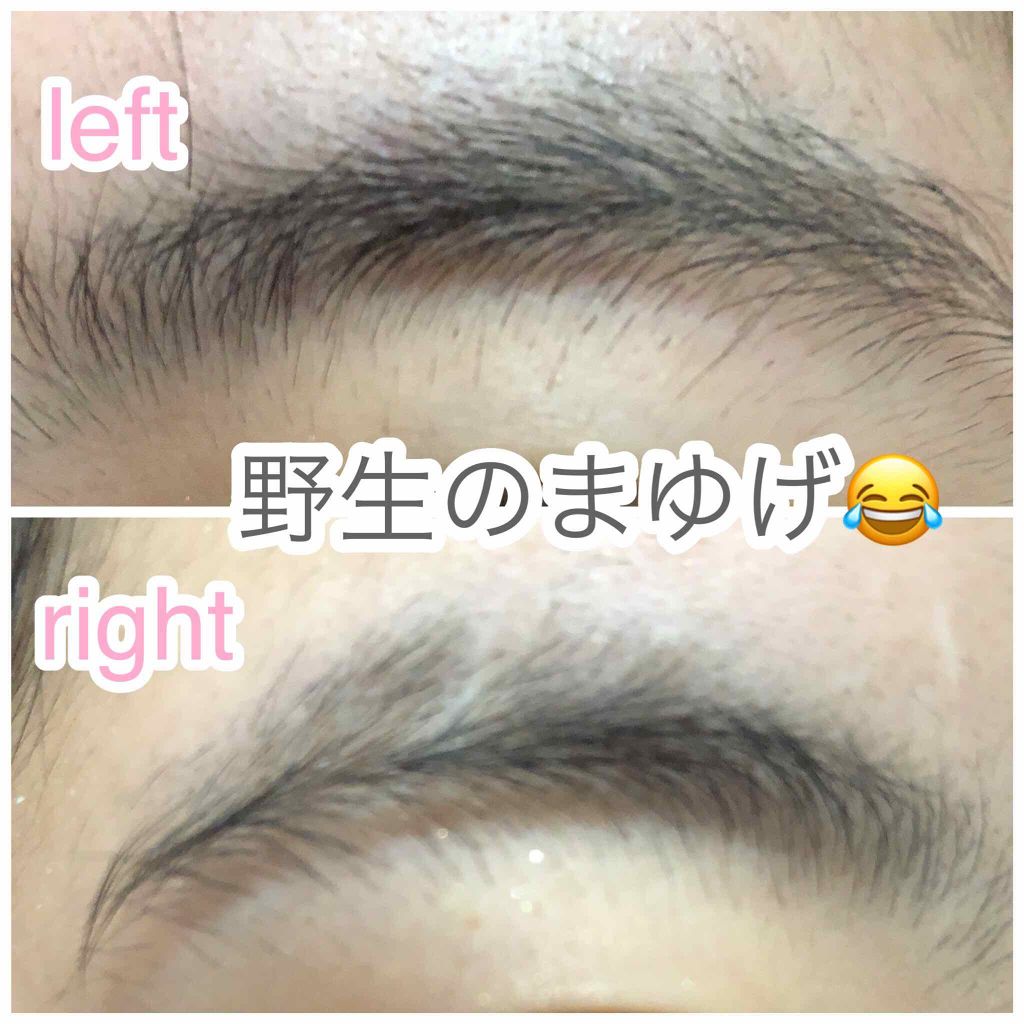 ラディアント タッチ/YVES SAINT LAURENT BEAUTE/リキッドコンシーラーを使ったクチコミ（3枚目）