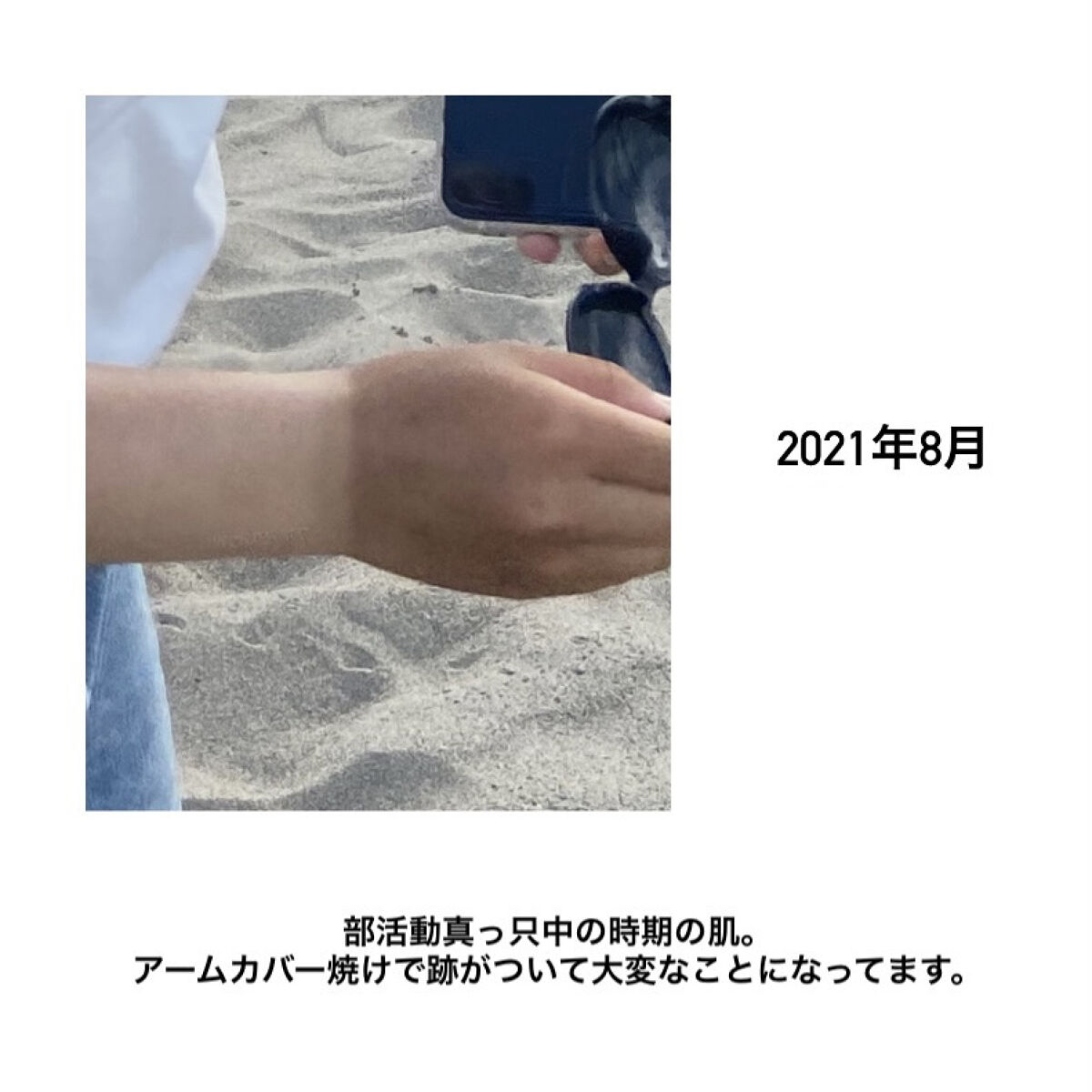 DHC ビタミンＣハードカプセル/DHC/美容サプリメントを使ったクチコミ（2枚目）