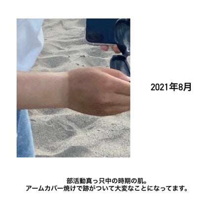 DHC ビタミンCハードカプセル/DHC/美容サプリメントを使ったクチコミ(2枚目)