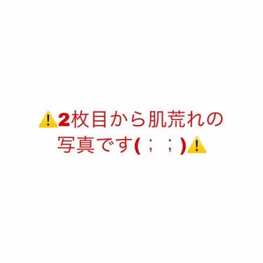 無印良品 敏感肌用薬用美白美容液のクチコミ「おはようございます。お久しぶりです。
１ヶ月経ちましたので、またご報告の投稿です。！


写真.....」（1枚目）