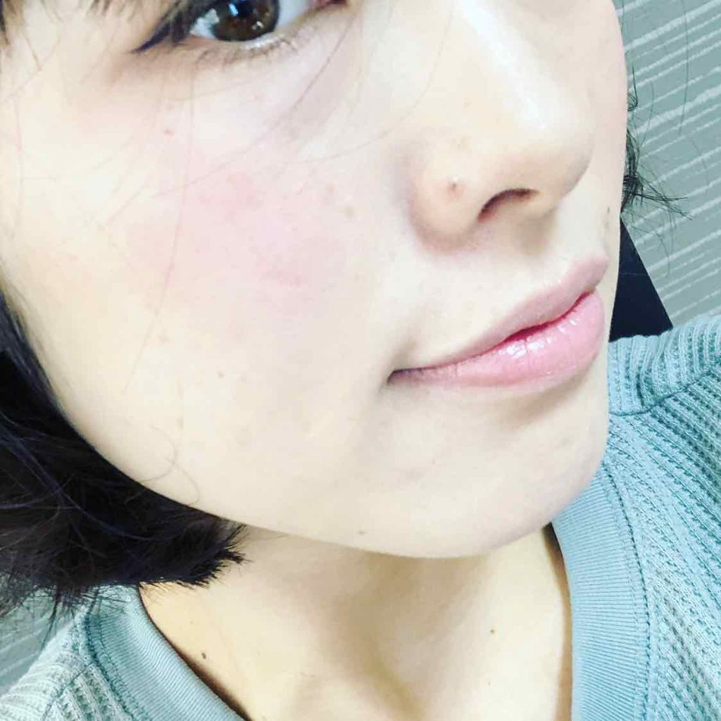 チーク ポップ/CLINIQUE/パウダーチークを使ったクチコミ(1枚目)