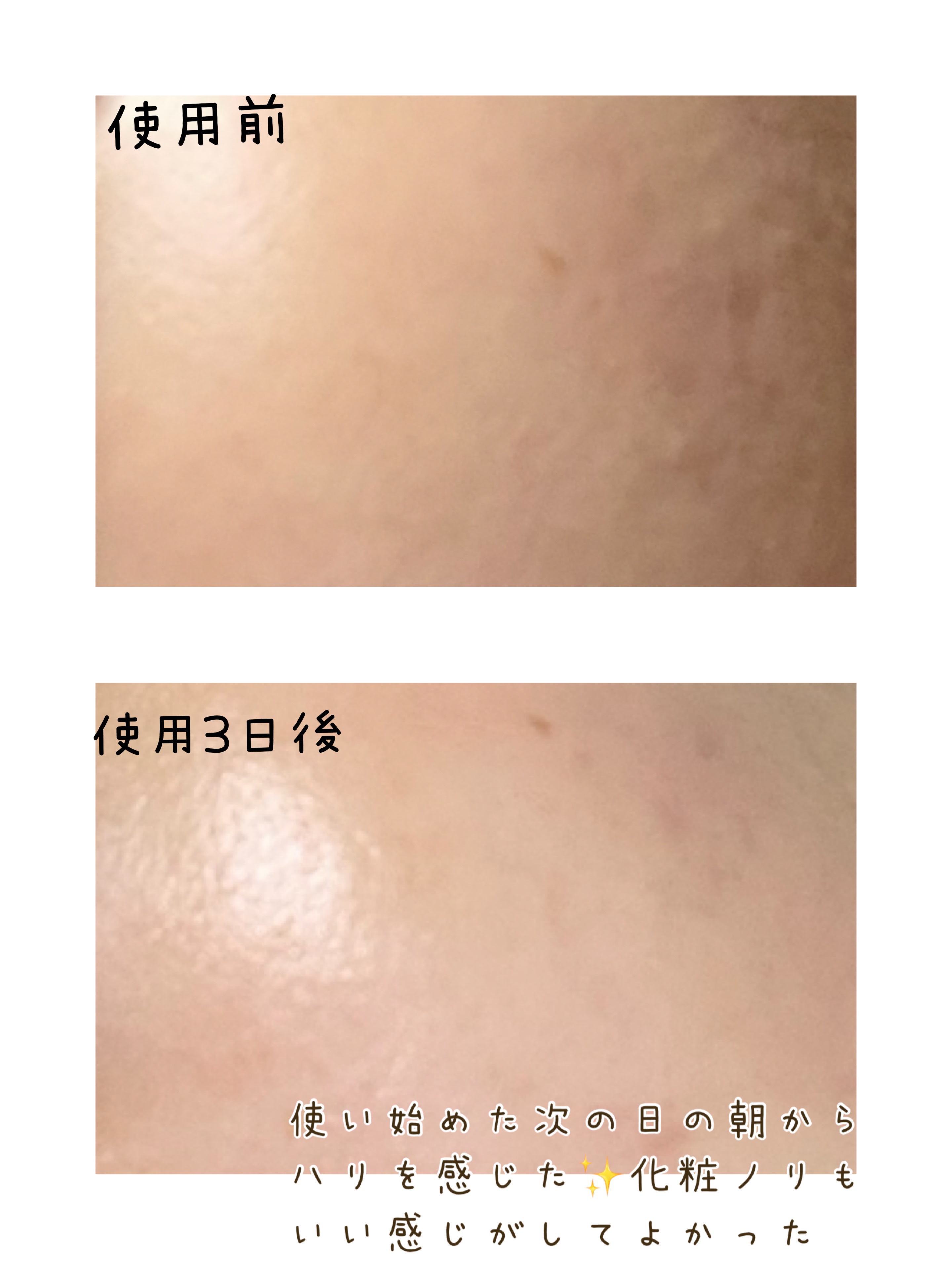 リードルショット300/VT/美容液を使ったクチコミ（2枚目）