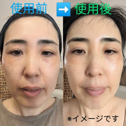 ルルルンプレシャス WHITE(クリア)【旧】/ルルルン/シートマスク・パックを使ったクチコミ(4枚目)