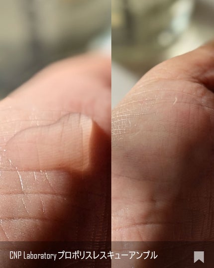 プロポリスレスキューアンプル 50ml/CNP Laboratory/美容液を使ったクチコミ(4枚目)