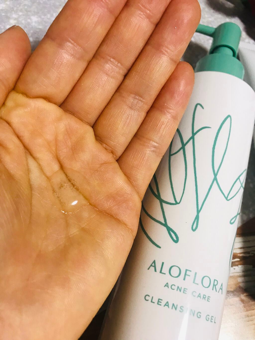 アロフローラ アクネケア クレンジングジェル/ハウス オブ ローゼ/クレンジングジェルを使ったクチコミ(1枚目)