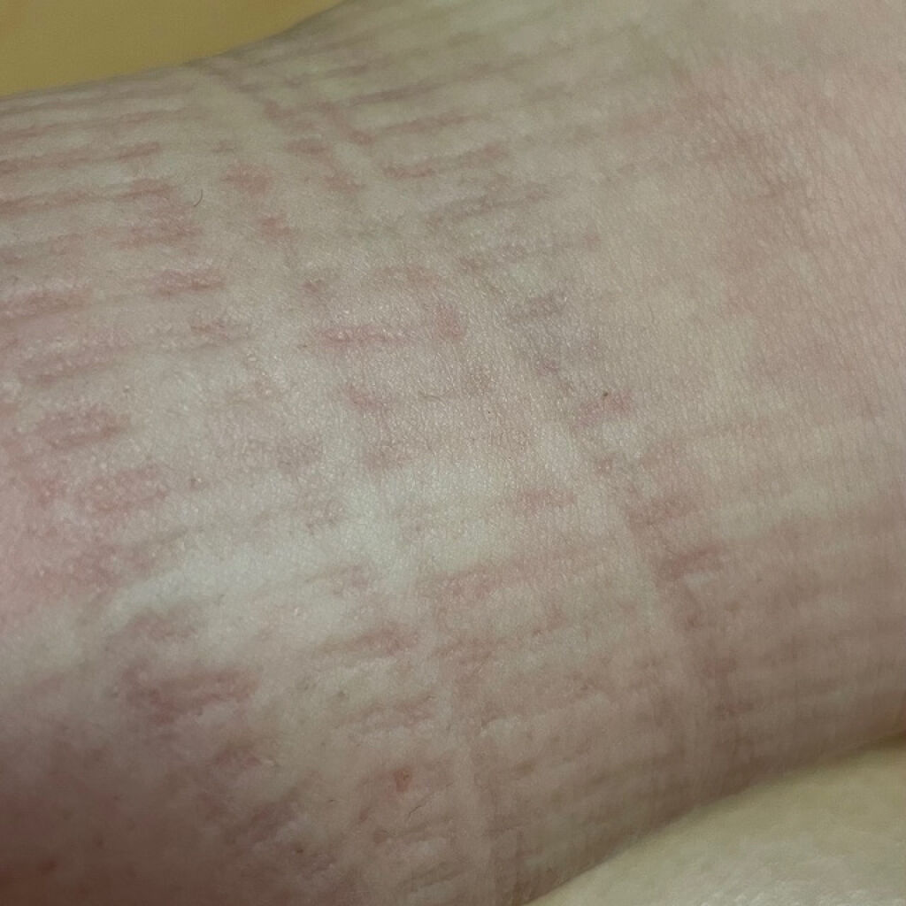 カリウムの力/Amazon Series/ボディサプリメントを使ったクチコミ（3枚目）