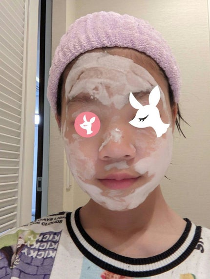 マジックバブルエッセンスパック(ピンク) /BAKER7/洗い流すパック・マスクを使ったクチコミ(4枚目)