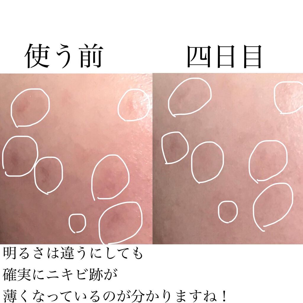 ヴィオテラス Cセラム/ヘルスビューティー/美容液を使ったクチコミ(5枚目)