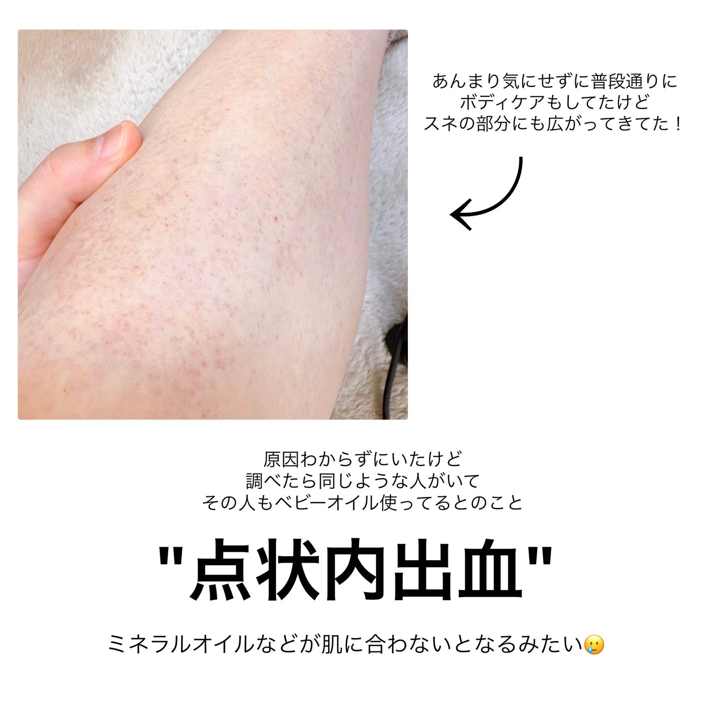 ジョンソン ベビーオイル 無香料/ジョンソンベビー/ボディオイルを使ったクチコミ(6枚目)