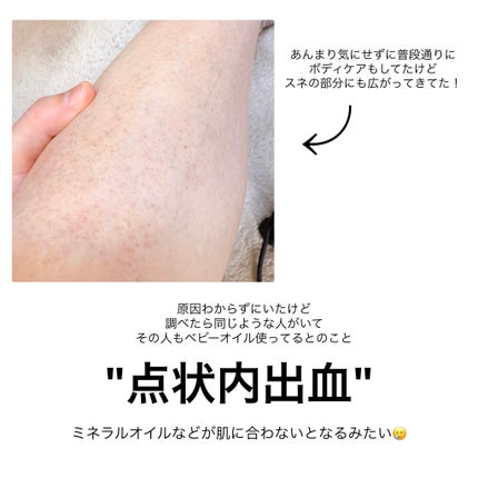 ジョンソン ベビーオイル 無香料/ジョンソンベビー/ボディオイルを使ったクチコミ(6枚目)