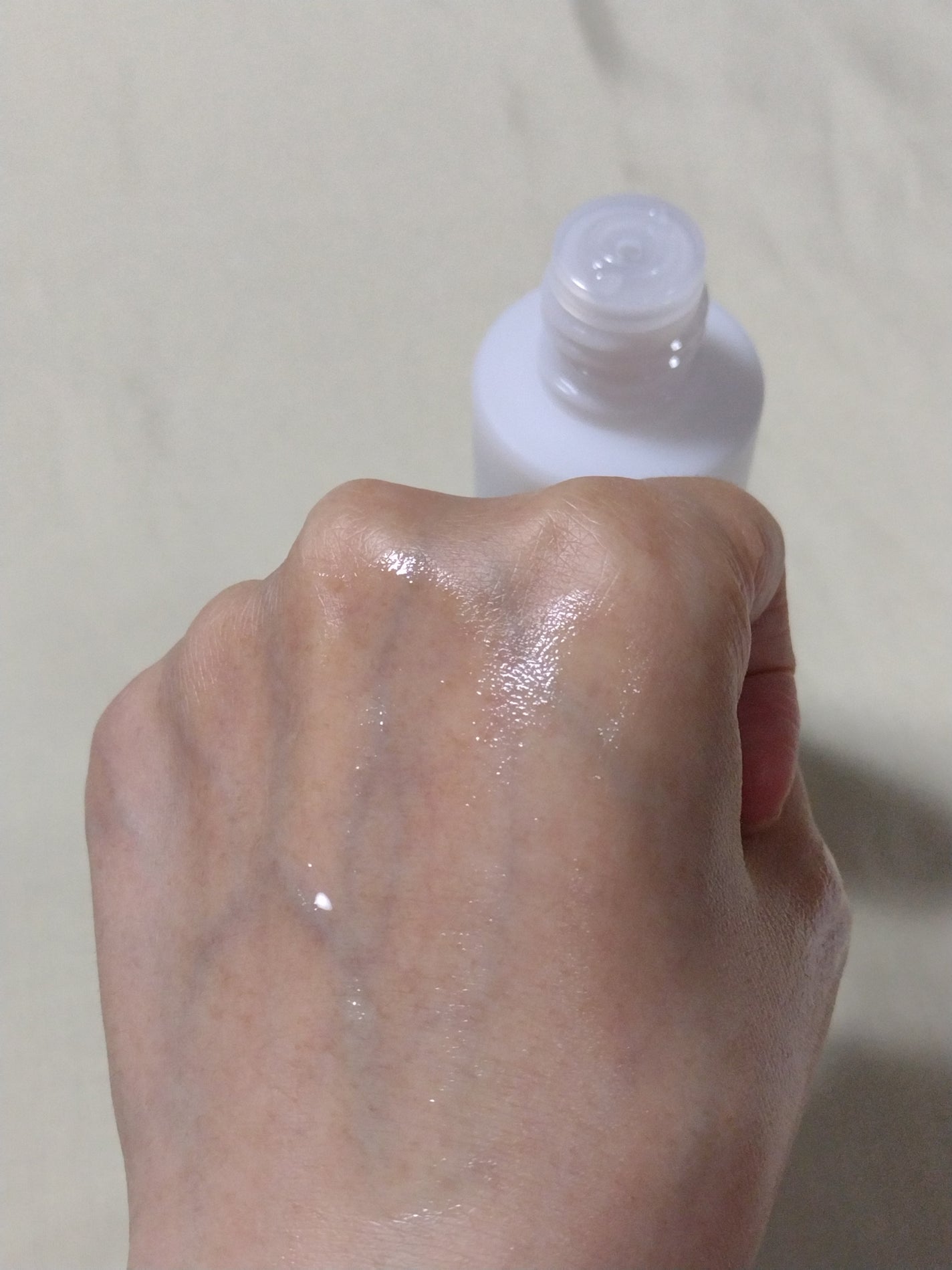 アカルミー化粧水/ワイズ/化粧水を使ったクチコミ(2枚目)