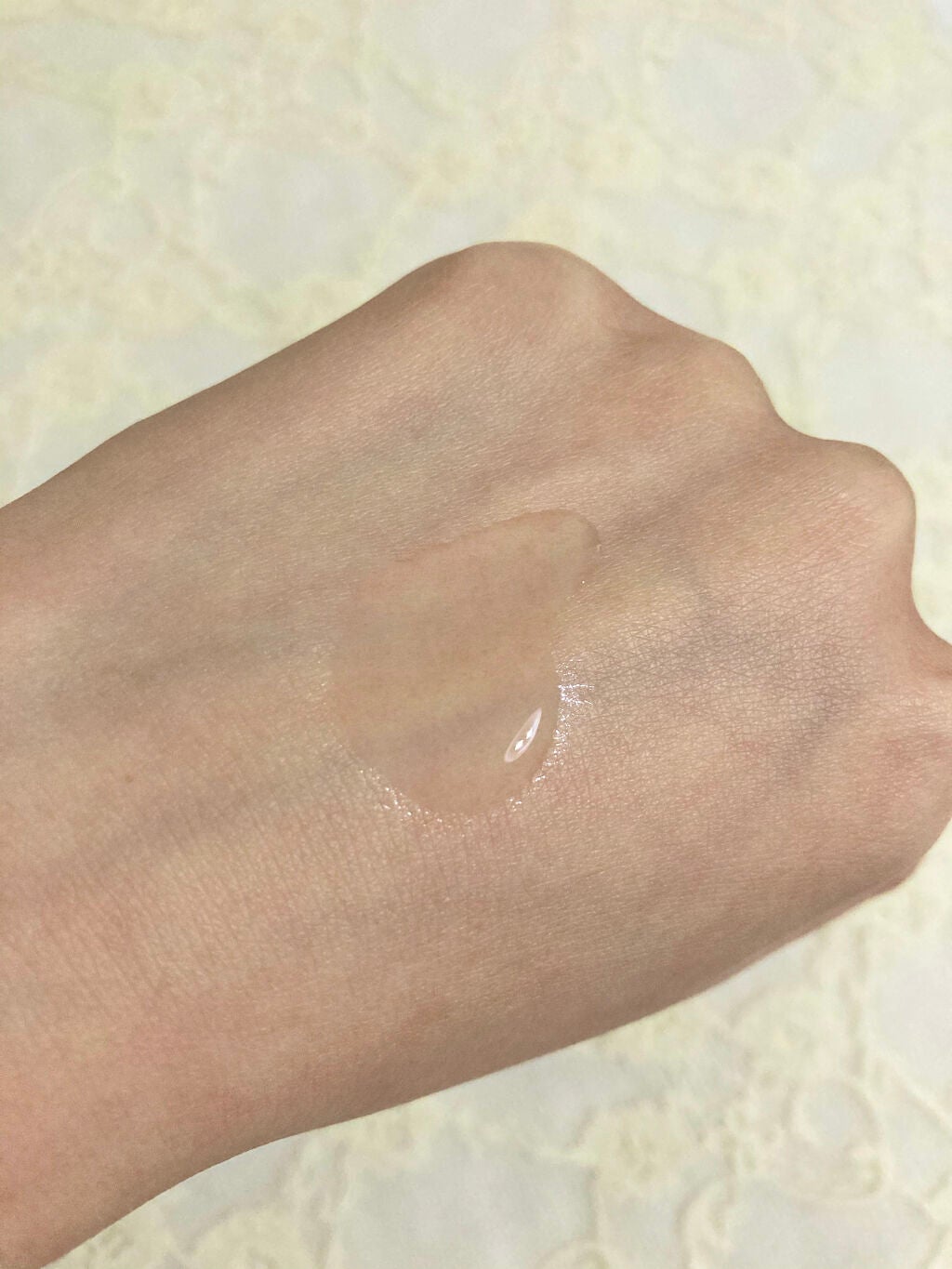 バイオイル/バイオイル/フェイスオイルを使ったクチコミ(2枚目)