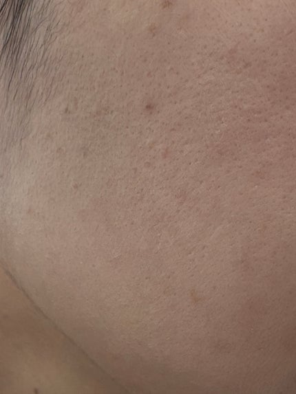 アイレノールすっぴんクリーム/IRENOL/クリームコンシーラーを使ったクチコミ(4枚目)