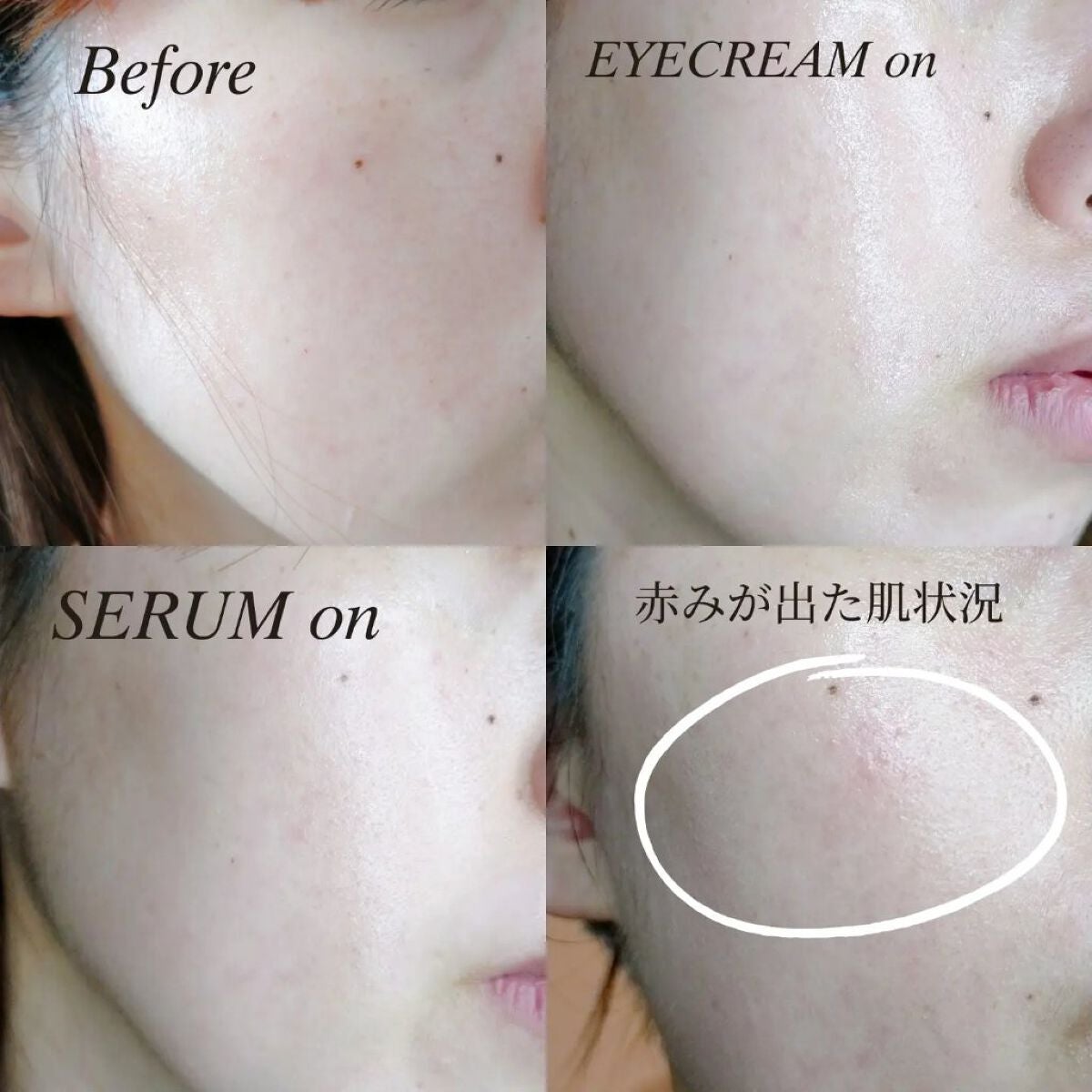 レチノールインテンシブ アドバンスドトリプルアクションアイクリーム/SOME BY MI/アイケア・アイクリームを使ったクチコミ(4枚目)