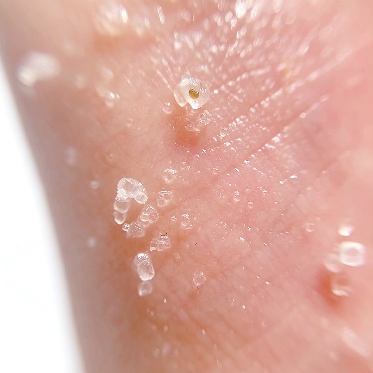 シーソルトセラピースカルプスケーラー/GROWUS/ヘッドスクラブを使ったクチコミ（3枚目）