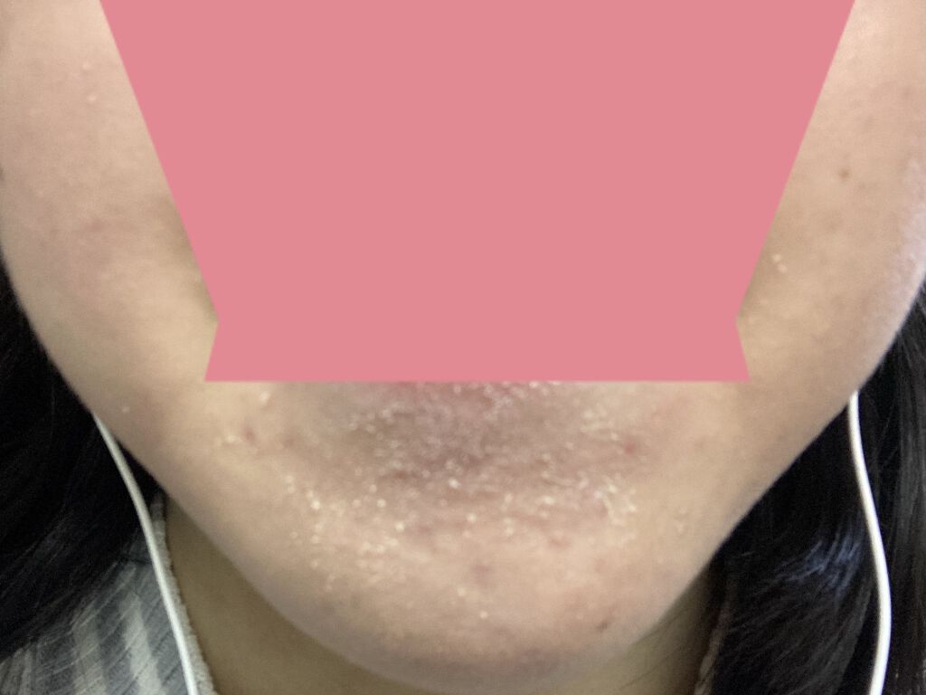 クリアウェルネス ピュア コンク/雪肌精/化粧水を使ったクチコミ（3枚目）