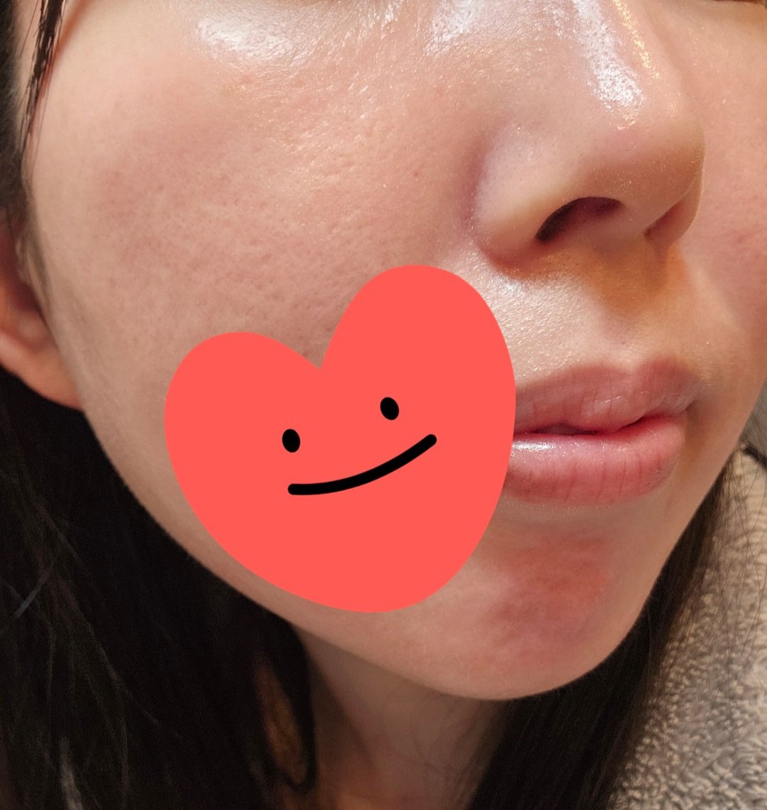 ダルバ ホワイトトリュフバイタルスプレーセラム/ダルバ/ミスト状化粧水を使ったクチコミ（3枚目）