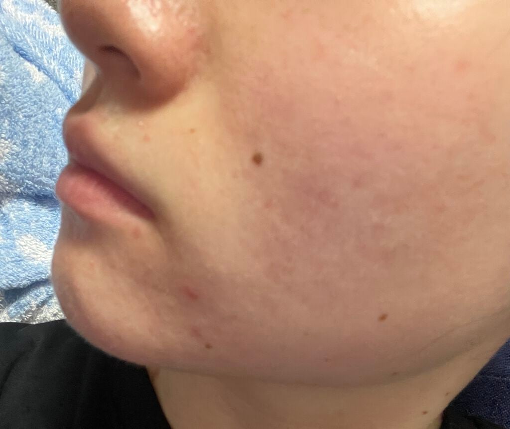 ソフティモ ディープ クレンジングオイル/ソフティモ/オイルクレンジングを使ったクチコミ(2枚目)