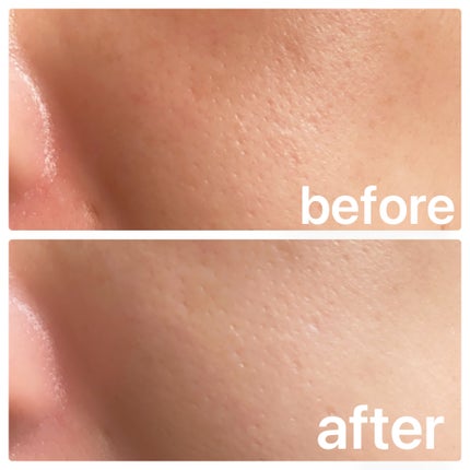 レッドブレミッシュ クリアスージングクリーム/Dr.G/フェイスクリームを使ったクチコミ(4枚目)