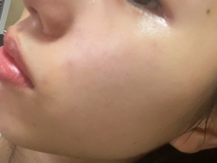 スペシャルジェルクリーム EX (ブライトニング) /アクアレーベル/オールインワン化粧品を使ったクチコミ(2枚目)