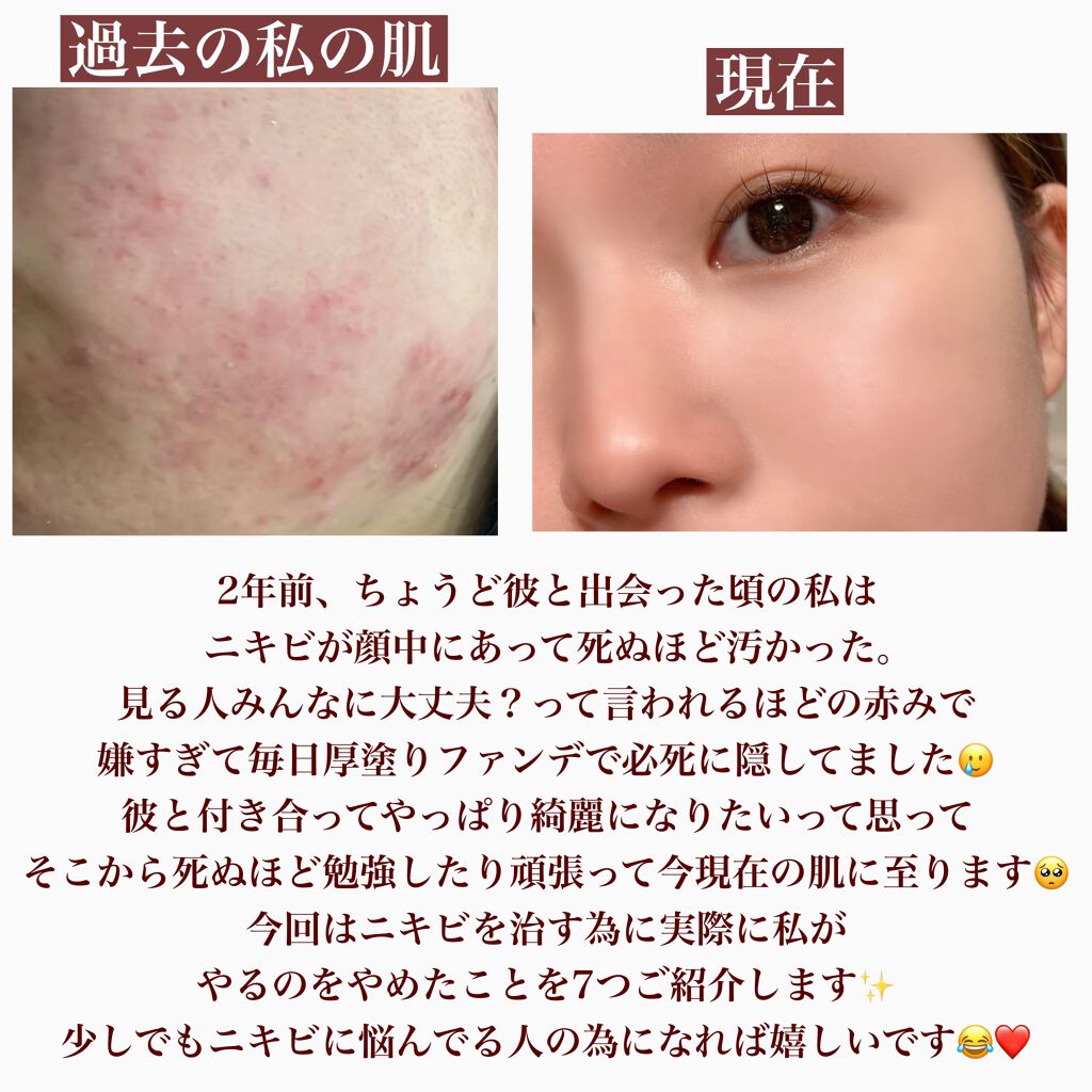 洗顔用泡立てネット/無印良品/その他スキンケアグッズを使ったクチコミ（2枚目）