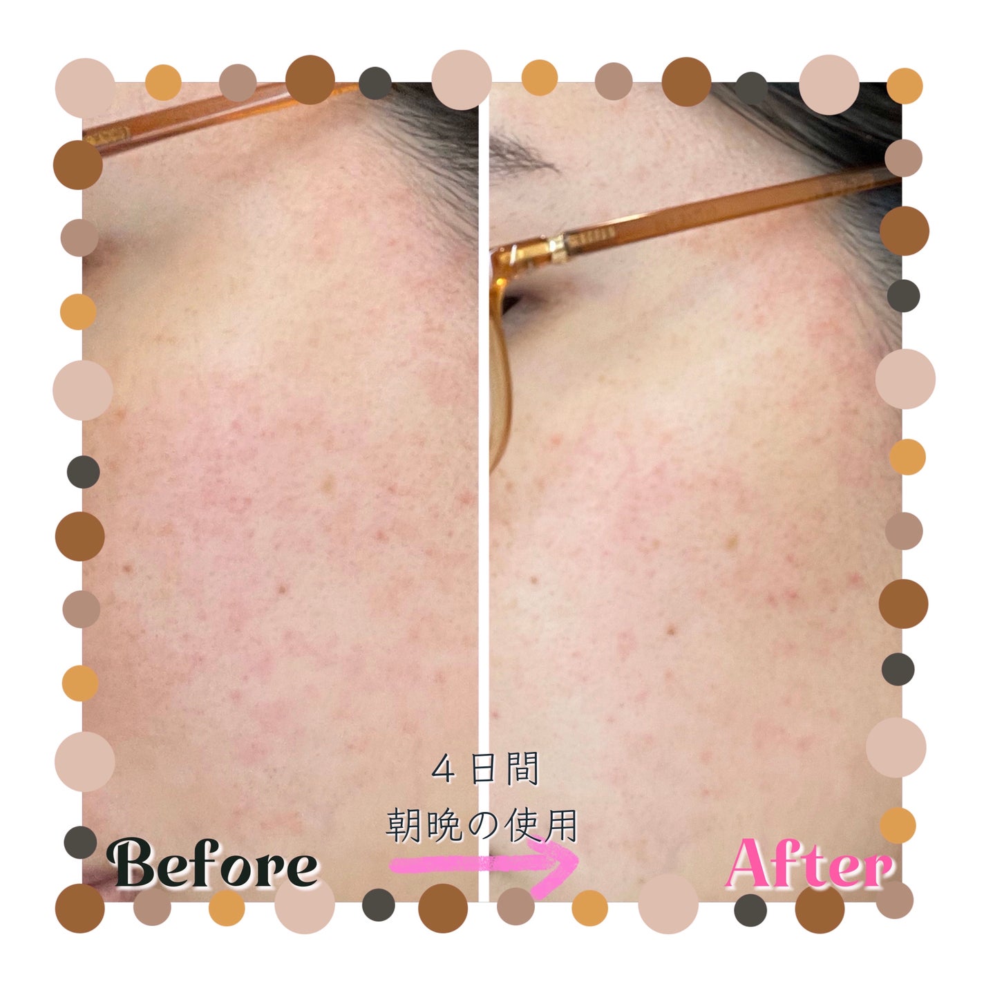 バリアサイクルトナー/P.CALM/化粧水を使ったクチコミ(1枚目)