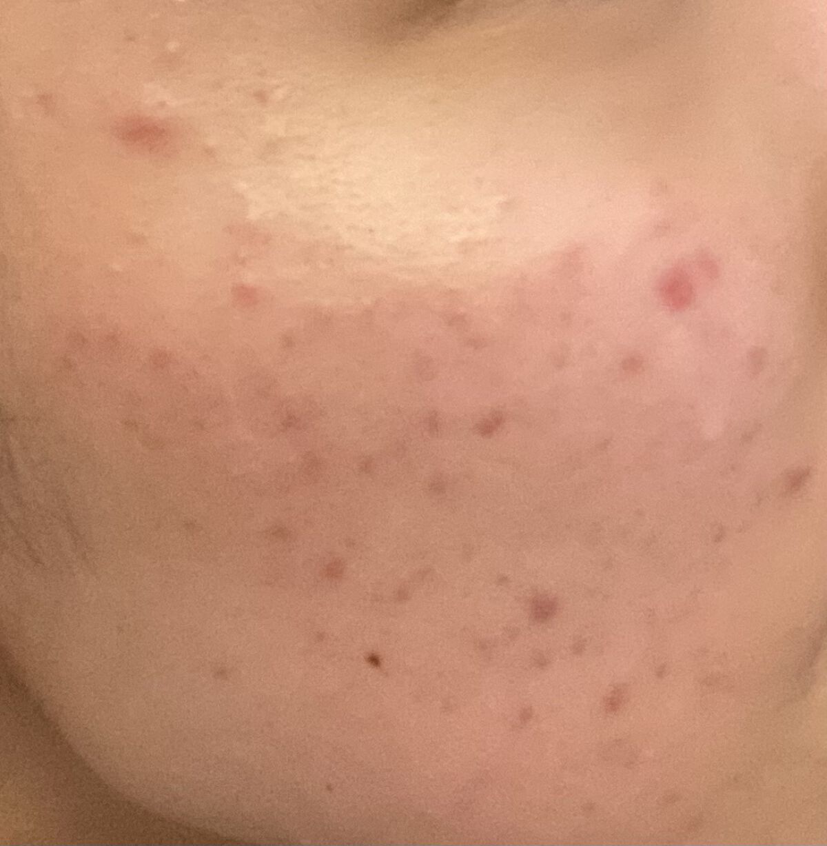 BCローション/DAISO/美容液を使ったクチコミ（2枚目）