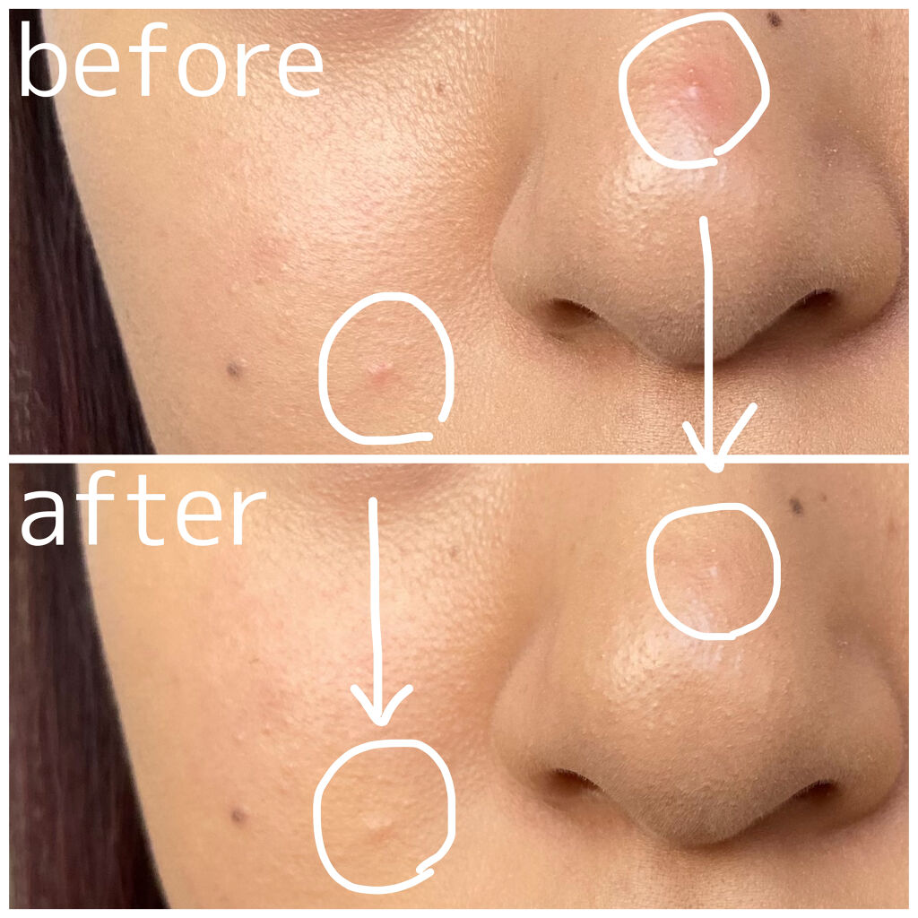 ラディアントクリーミーコンシーラー 1244 CUSTARD/NARS/リキッドコンシーラーを使ったクチコミ（3枚目）