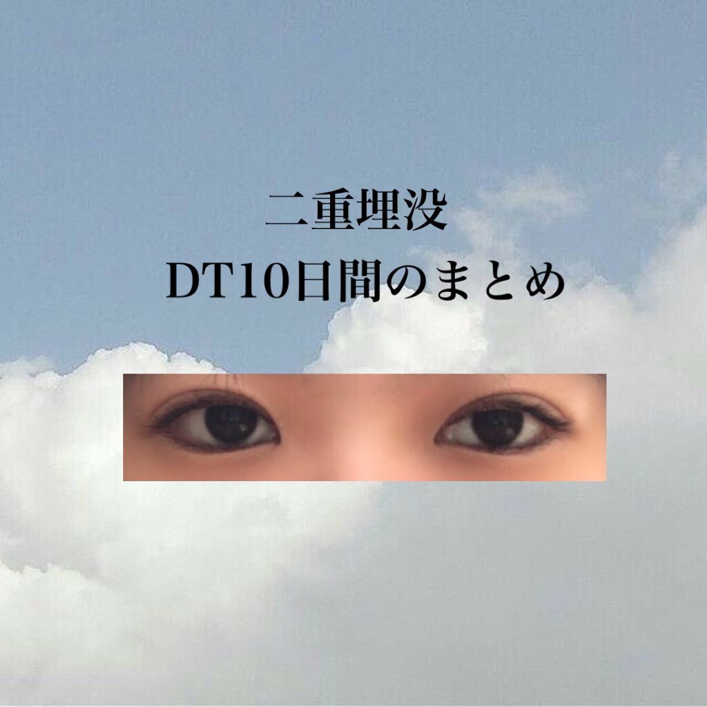 二重整形/その他を使ったクチコミ（1枚目）