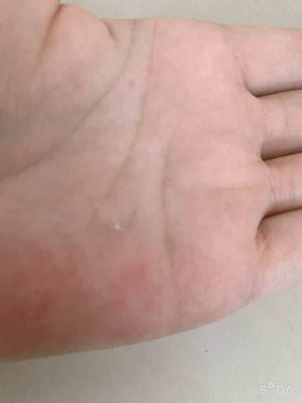 テラスキン/LINE REPAIR/美容液を使ったクチコミ(4枚目)