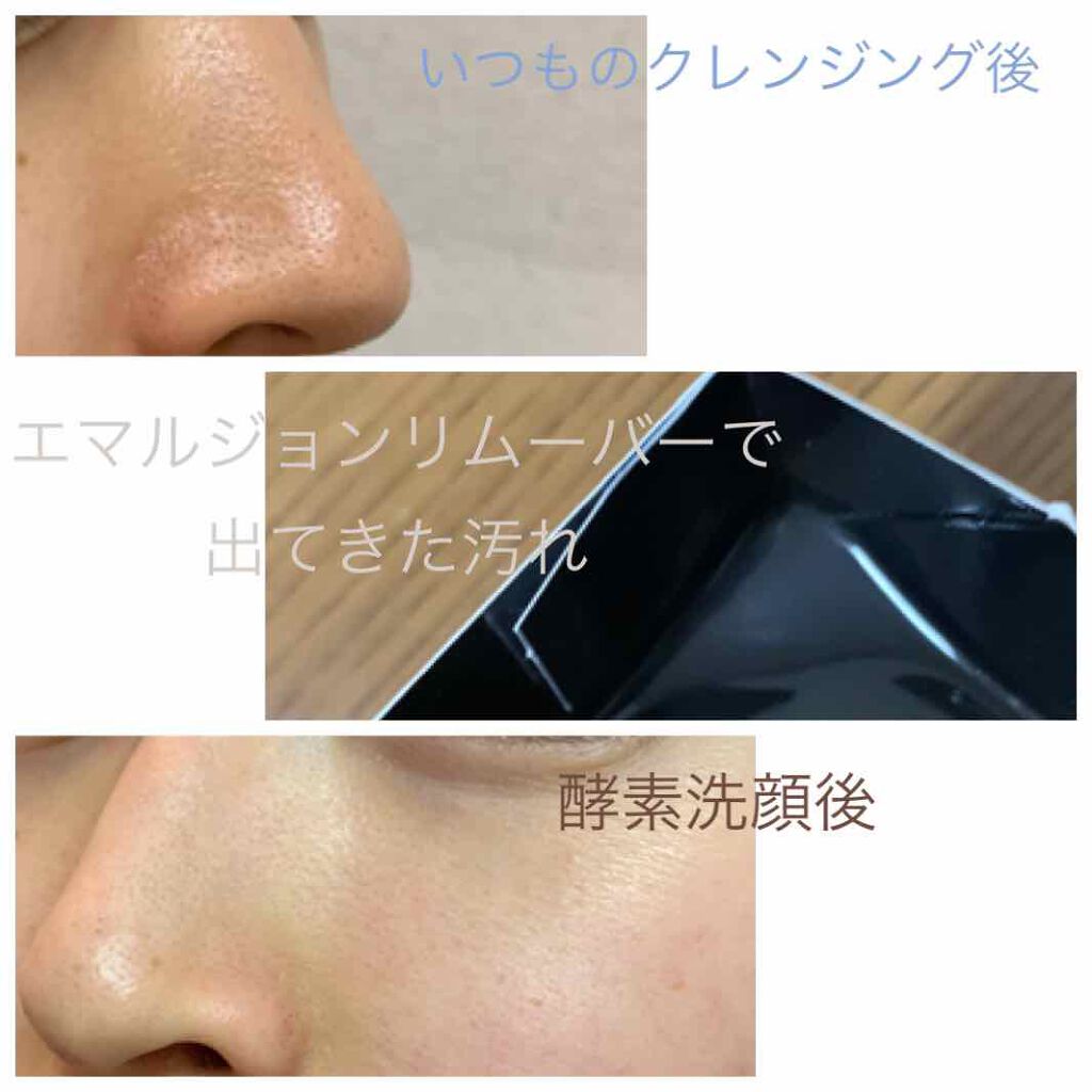 エマルジョンリムーバー　300ml/200ml/水橋保寿堂製薬/その他洗顔料を使ったクチコミ（2枚目）