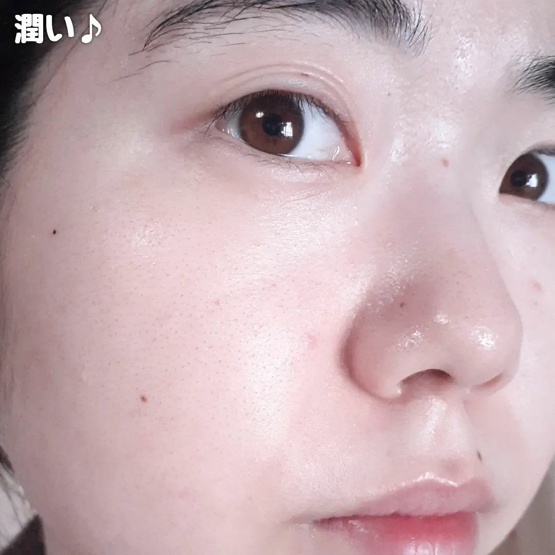 レッドブレミッシュクイックPHAシートマスク/Dr.G/シートマスク・パックを使ったクチコミ(6枚目)