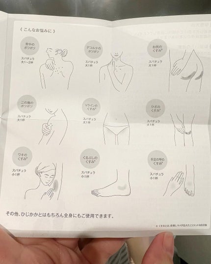 タカミスキンピールボディ/タカミ/ボディローションを使ったクチコミ(4枚目)