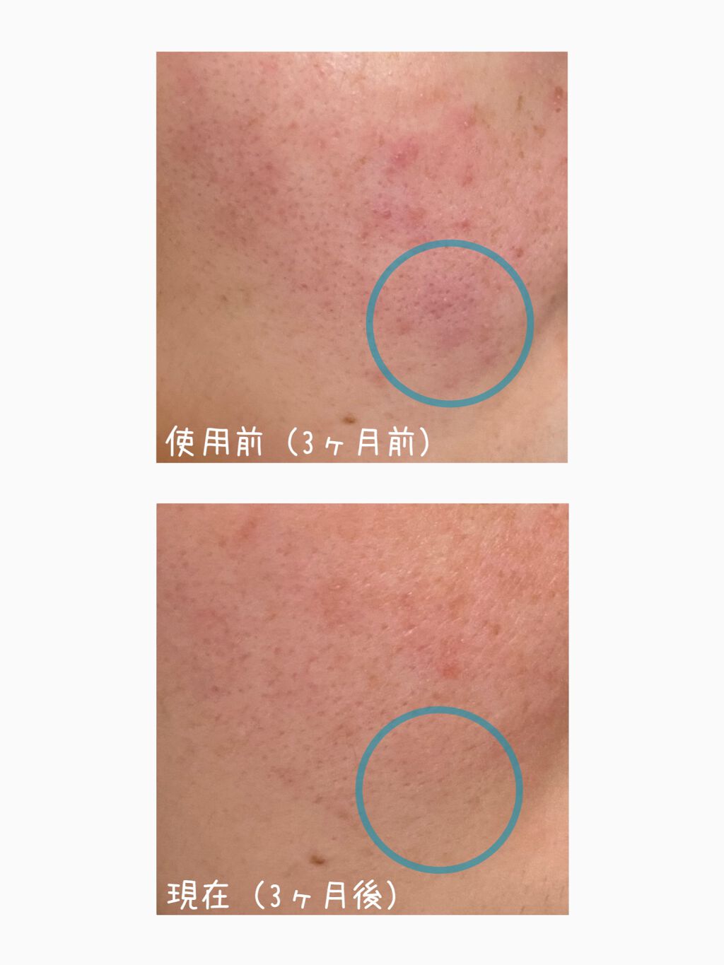 クリアケア化粧水 高保湿タイプ/無印良品/化粧水を使ったクチコミ（2枚目）