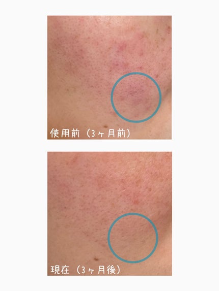 クリアケア化粧水 高保湿タイプ/無印良品/化粧水を使ったクチコミ(2枚目)