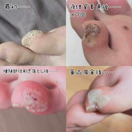 を使ったクチコミ(3枚目)