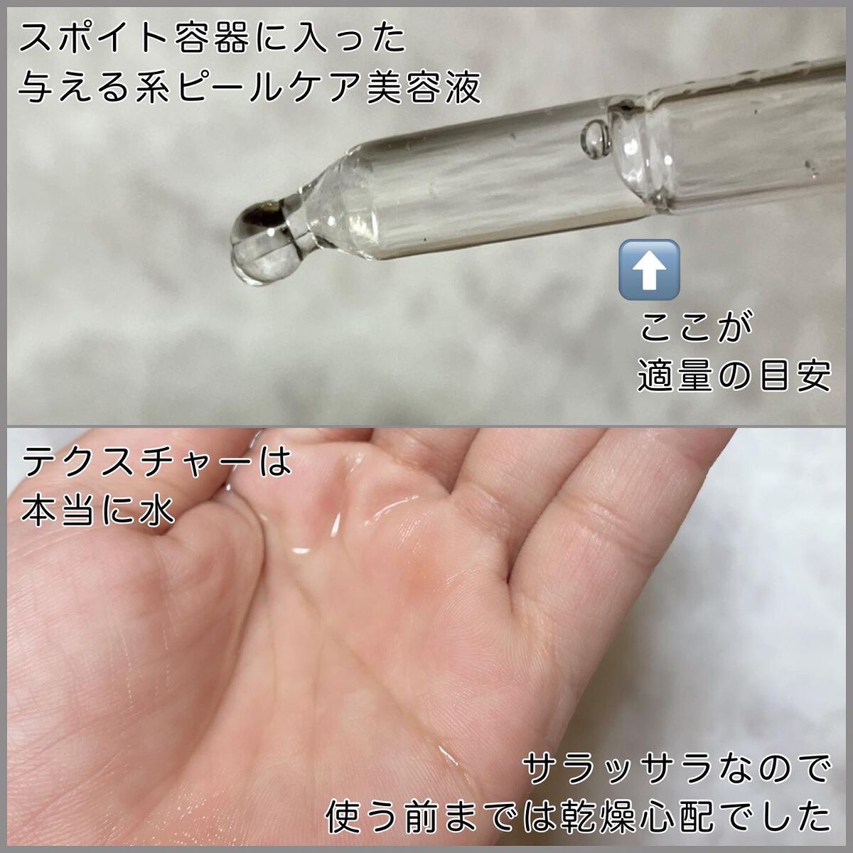 タカミスキンピール/タカミ/ブースター・導入液を使ったクチコミ(2枚目)