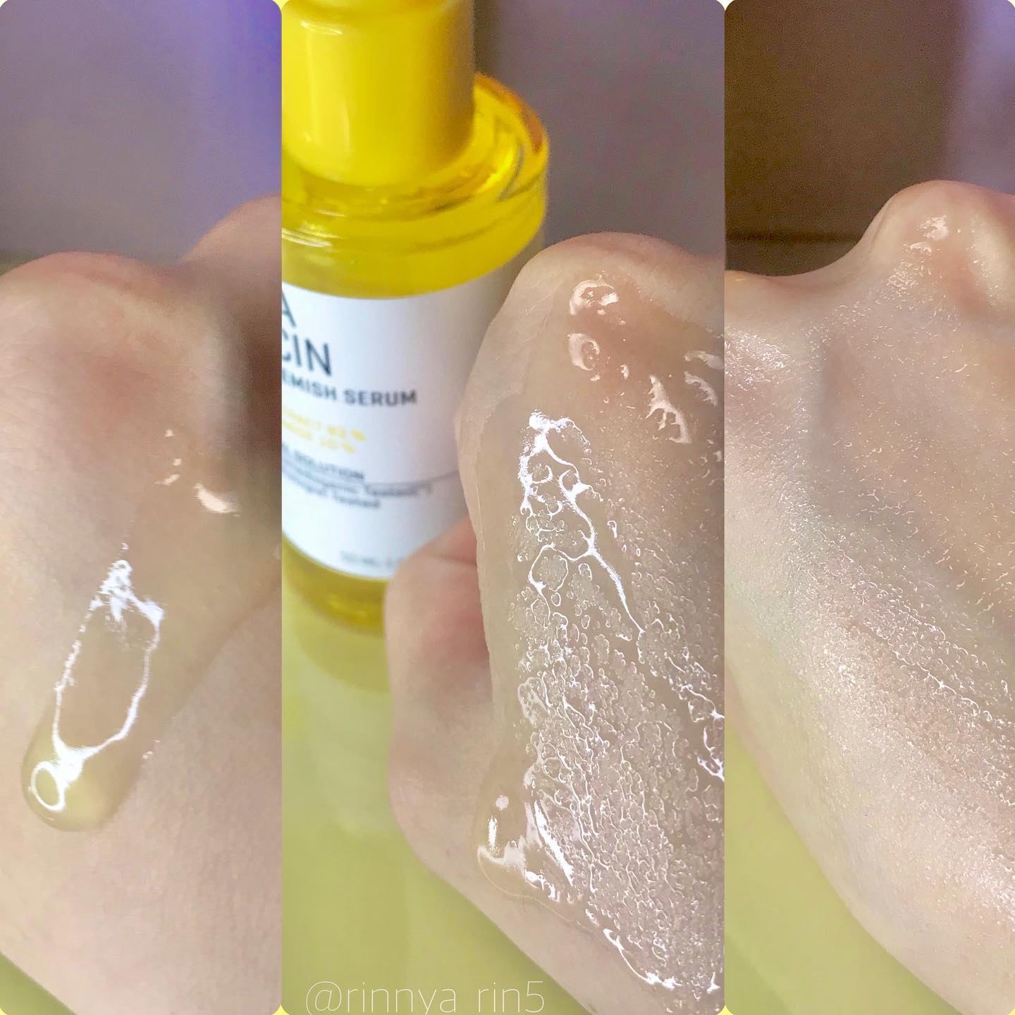 ユズナイアシンアンチブレミッシュセラム/SOME BY MI/美容液を使ったクチコミ（3枚目）