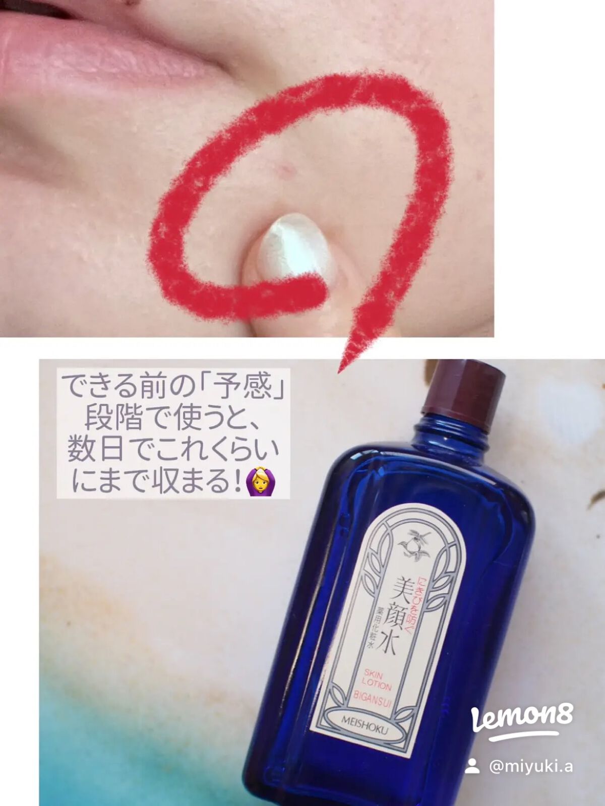 明色美顔水 薬用化粧水/美顔/化粧水を使ったクチコミ(3枚目)