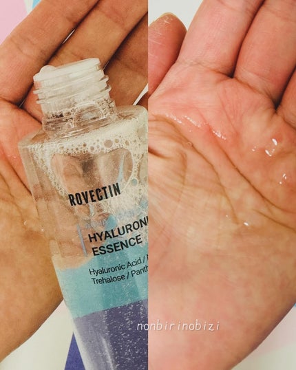 アクアヒアルロニックエッセンス/ロベクチン/化粧水を使ったクチコミ(5枚目)