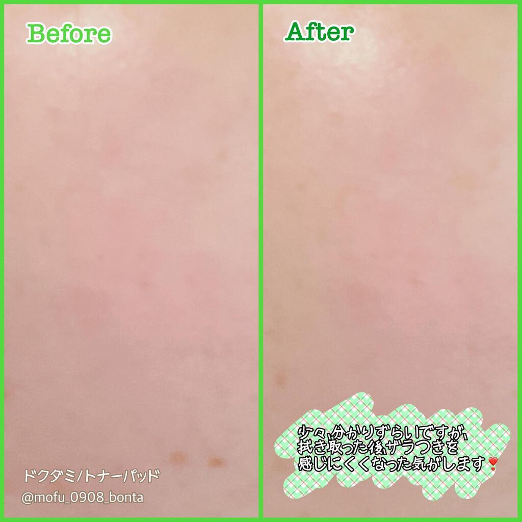 グーダルHCトナーパッド /goodal/トナーパッドを使ったクチコミ（3枚目）