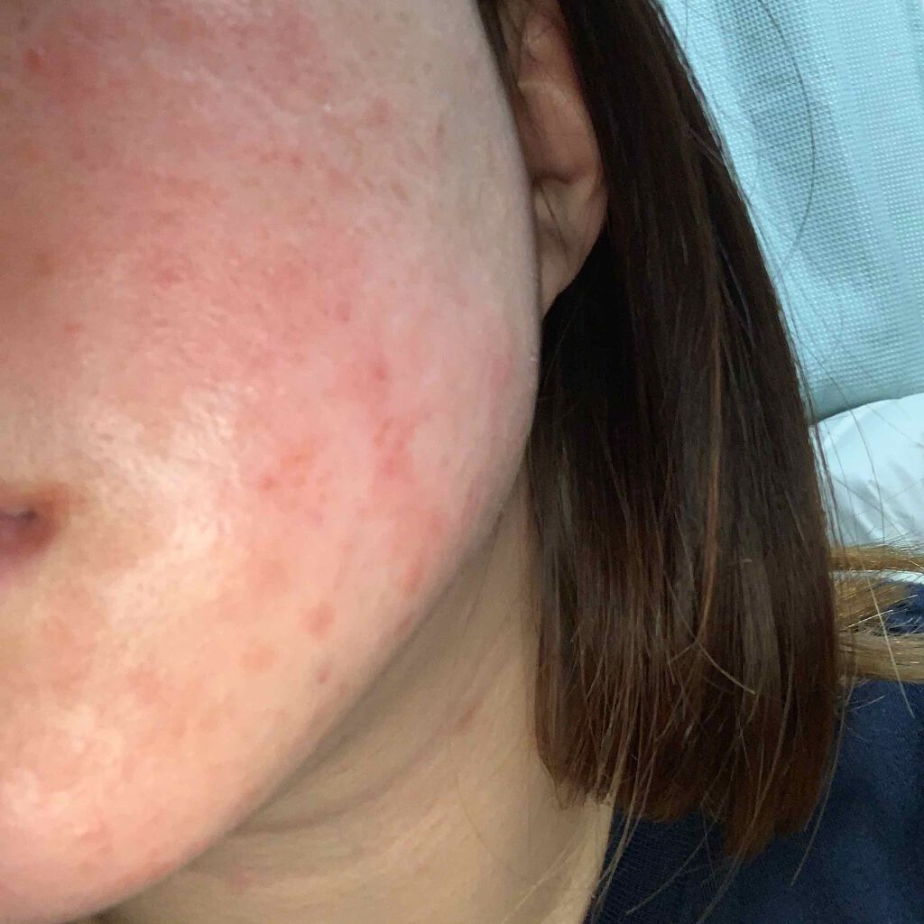 ロコベースリペア クリーム/ロコベース/ハンドクリームを使ったクチコミ（2枚目）