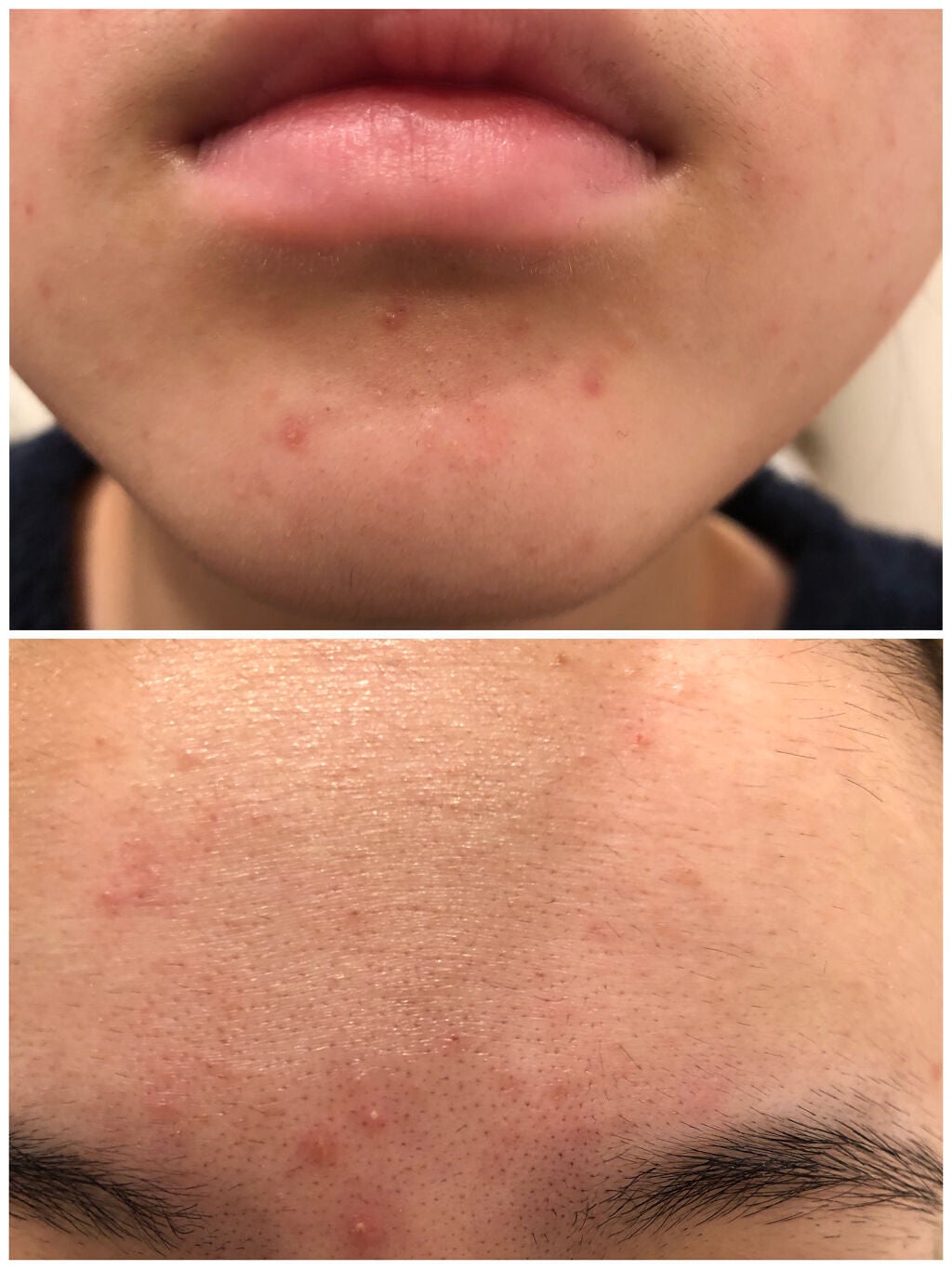 DHC はとむぎエキス/DHC/健康サプリメントを使ったクチコミ(5枚目)