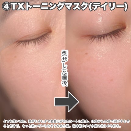 リードルショット300/VT/美容液を使ったクチコミ(6枚目)