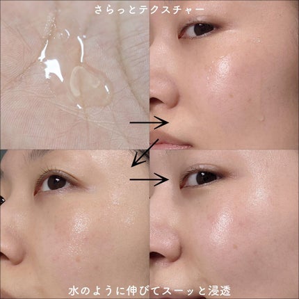 センテラ アンプル/SKIN1004/美容液を使ったクチコミ(5枚目)