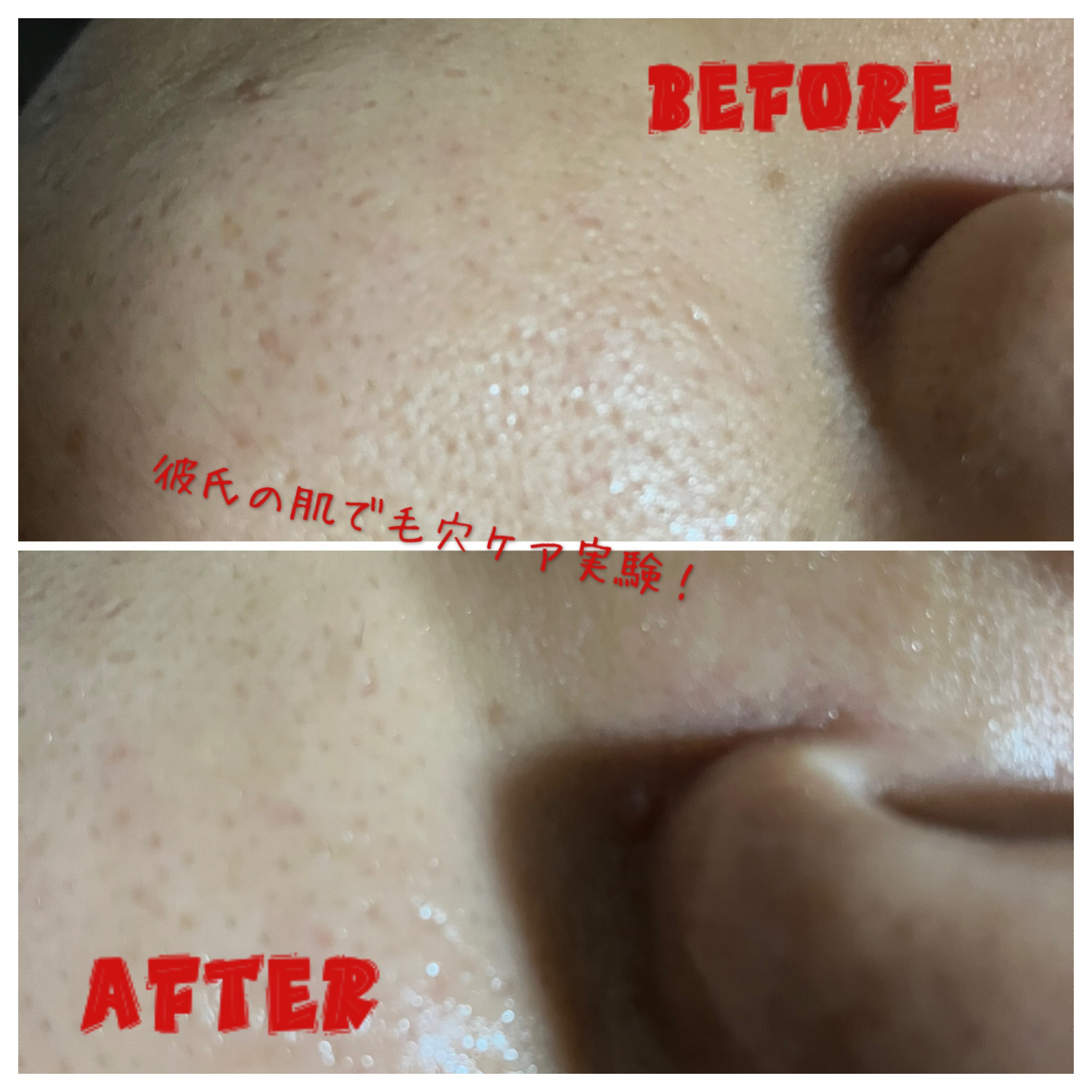 収れん美容液/MULC/美容液を使ったクチコミ（1枚目）