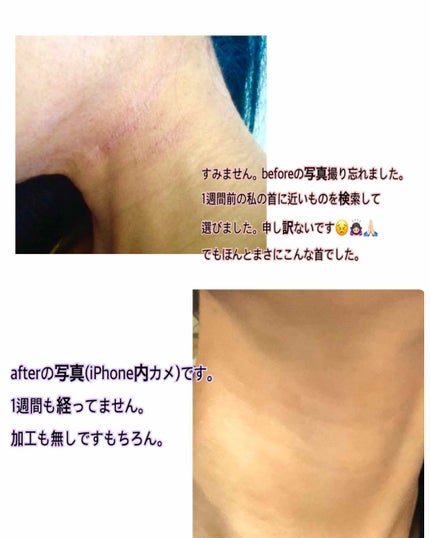 ピュアベール(医薬品)/プロペト/その他を使ったクチコミ(3枚目)