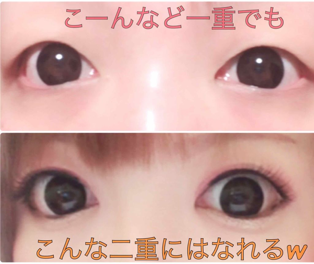 きたあや on LIPS 「🌸雑談特別編vol.②🌸二重整形しようと思った決意の巻おいらは..」(2枚目)