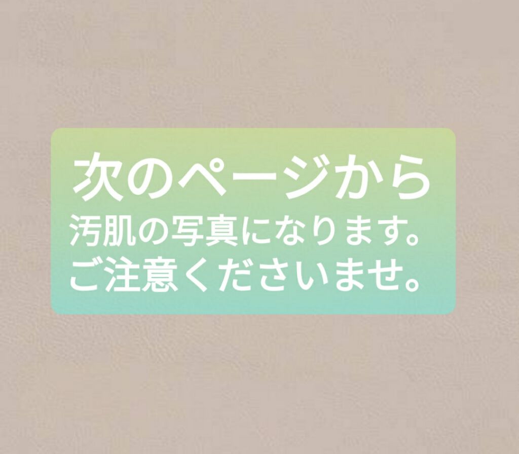 精製水（医薬品）/健栄製薬/その他を使ったクチコミ（2枚目）